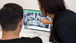 Proceso-implantes-dentales-inmediatos-Grupo-Clínico-Javier-Cabrera