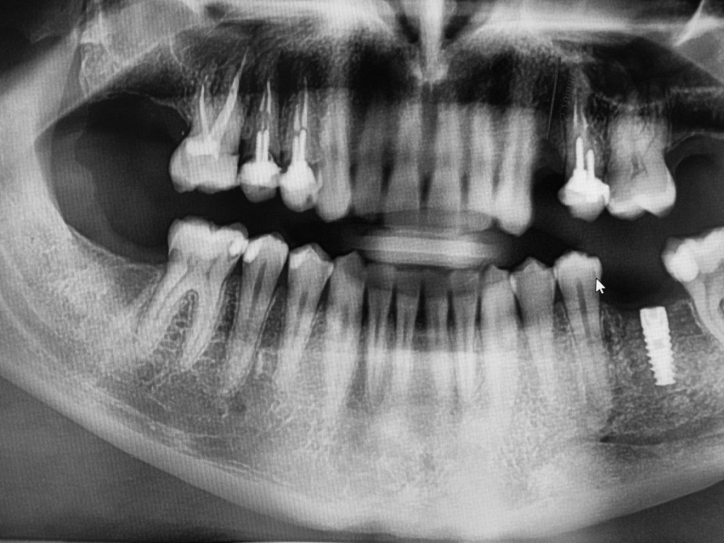 TAC dental en clínica dental de Onda - Grupo Clínico Javier Cabrera