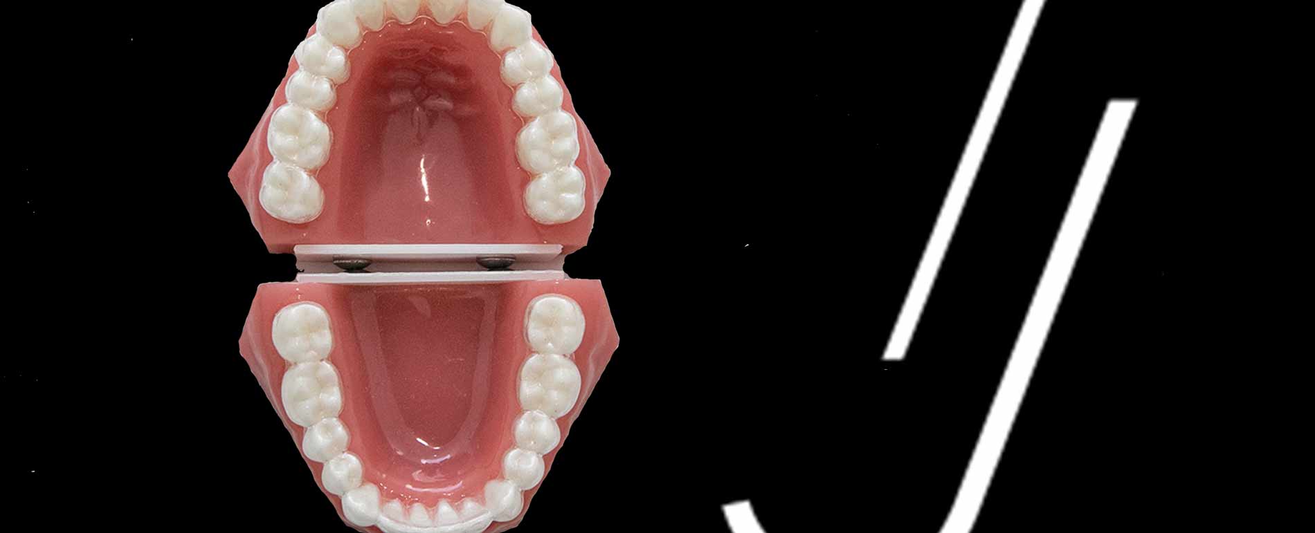 analisis oclusal