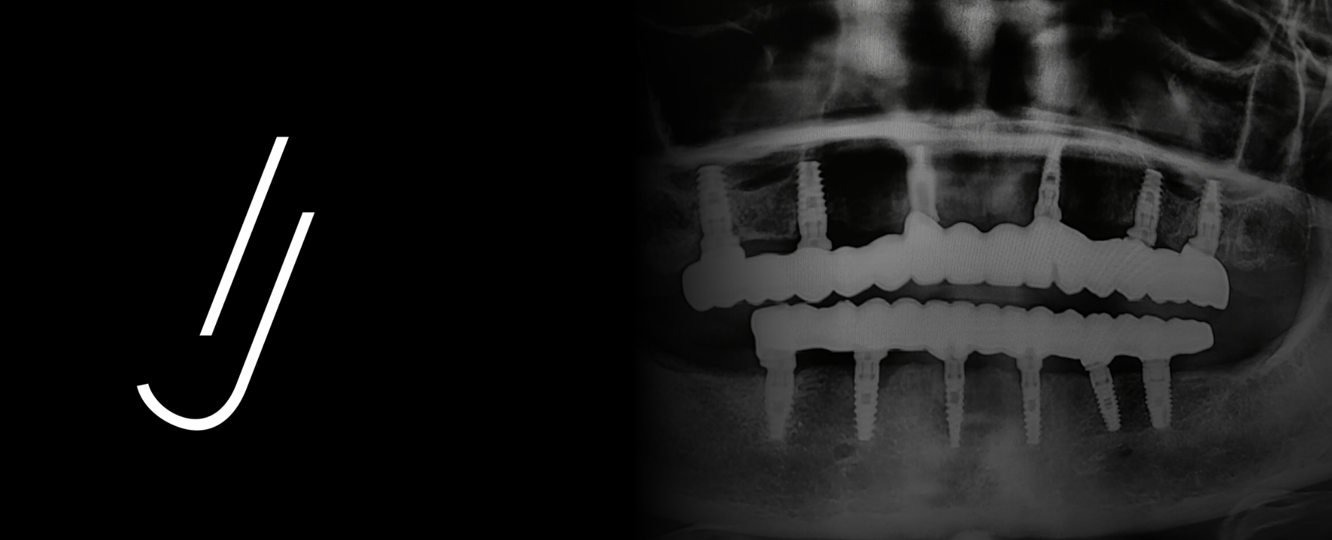 imagen radiografía periapical