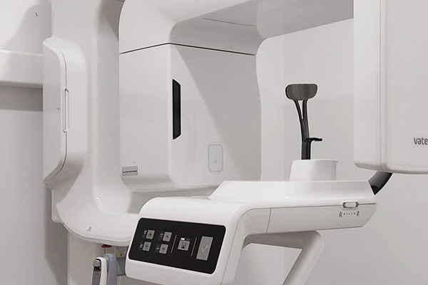 Tecnología punta en radiografías oclusales