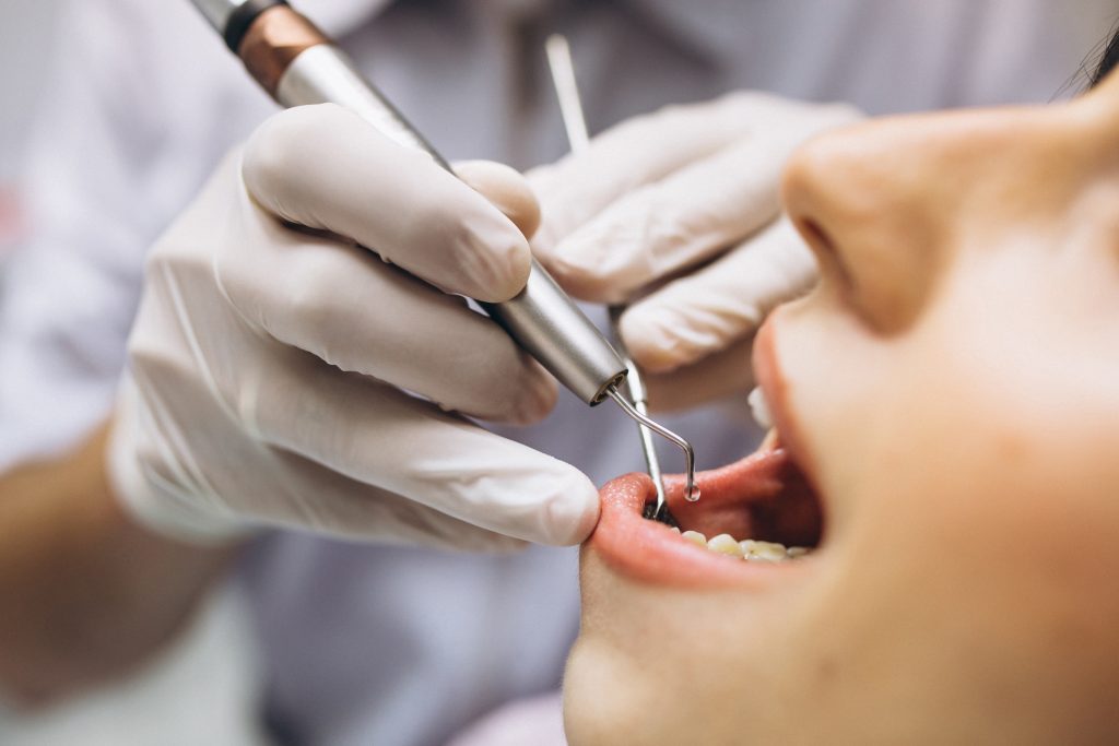 dentista hace limpieza dental a paciente