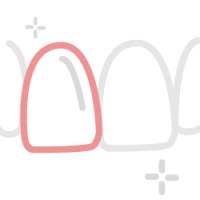 Servicios Odontología Dentista Castellón Icono Carillas Inmediatas