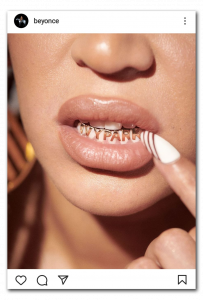 Grillz_Beyonce_Peligros_Esteticos_Grupo_Clinico_Javier_Cabrera_