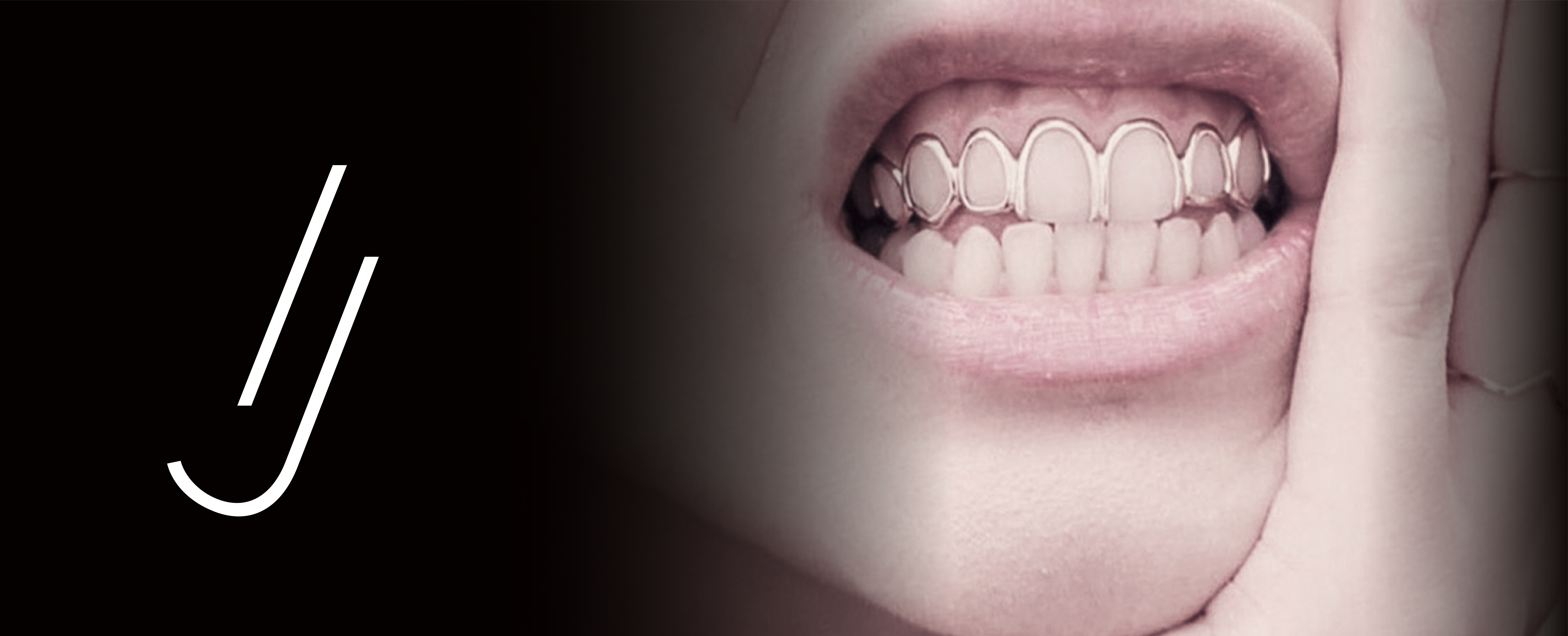 Peligrosas_Tendencias_Estetica_Dental_Grillz_Clinica_Dental_Javier_Cabrera