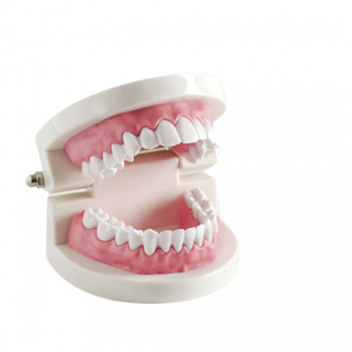 sonrisa gingival maqueta dentista cabrera Castellón