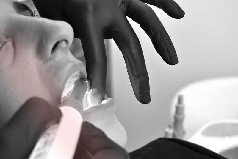 Radiografia-dental-escaner-castellon