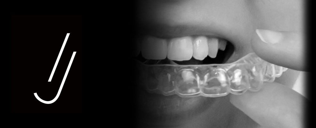Precio-de-una-ortodoncia-invisible